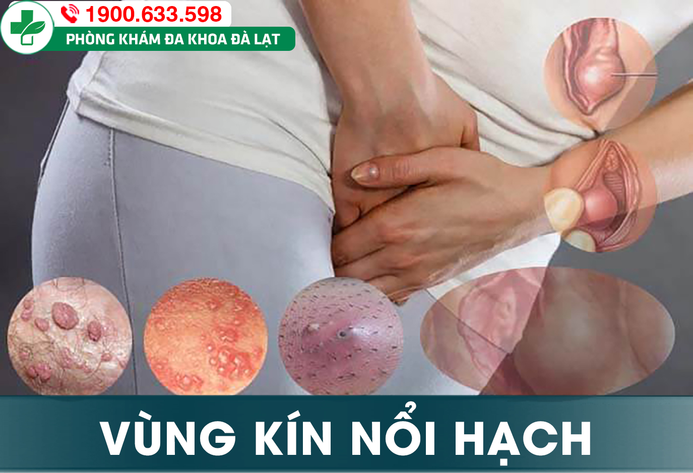 NỔI HẠCH Ở VÙNG KÍN NAM: NGUYÊN NHÂN VÀ CÁCH ĐIỀU TRỊ